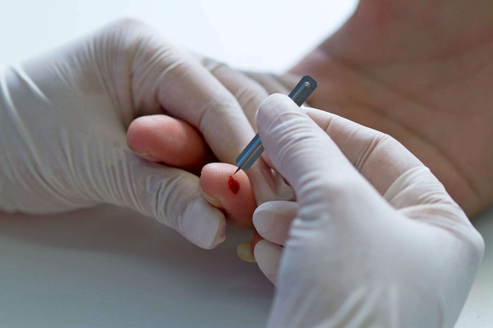 Анализ крови из пальца можно есть. Прокол пальца для взятия крови. Кровь из пальца прокол.